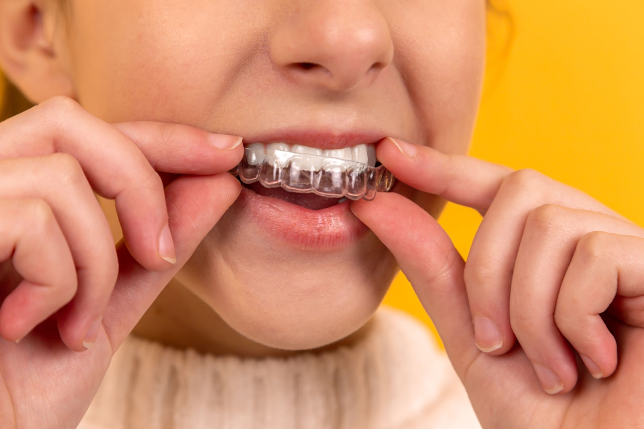 Endodonti — Kanal Tedavisi — Vatan Diş Kliniği