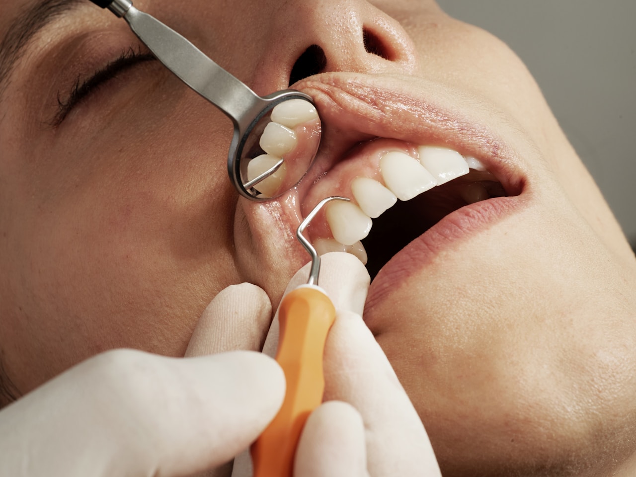 Ortodonti — Vatan Diş Kliniği